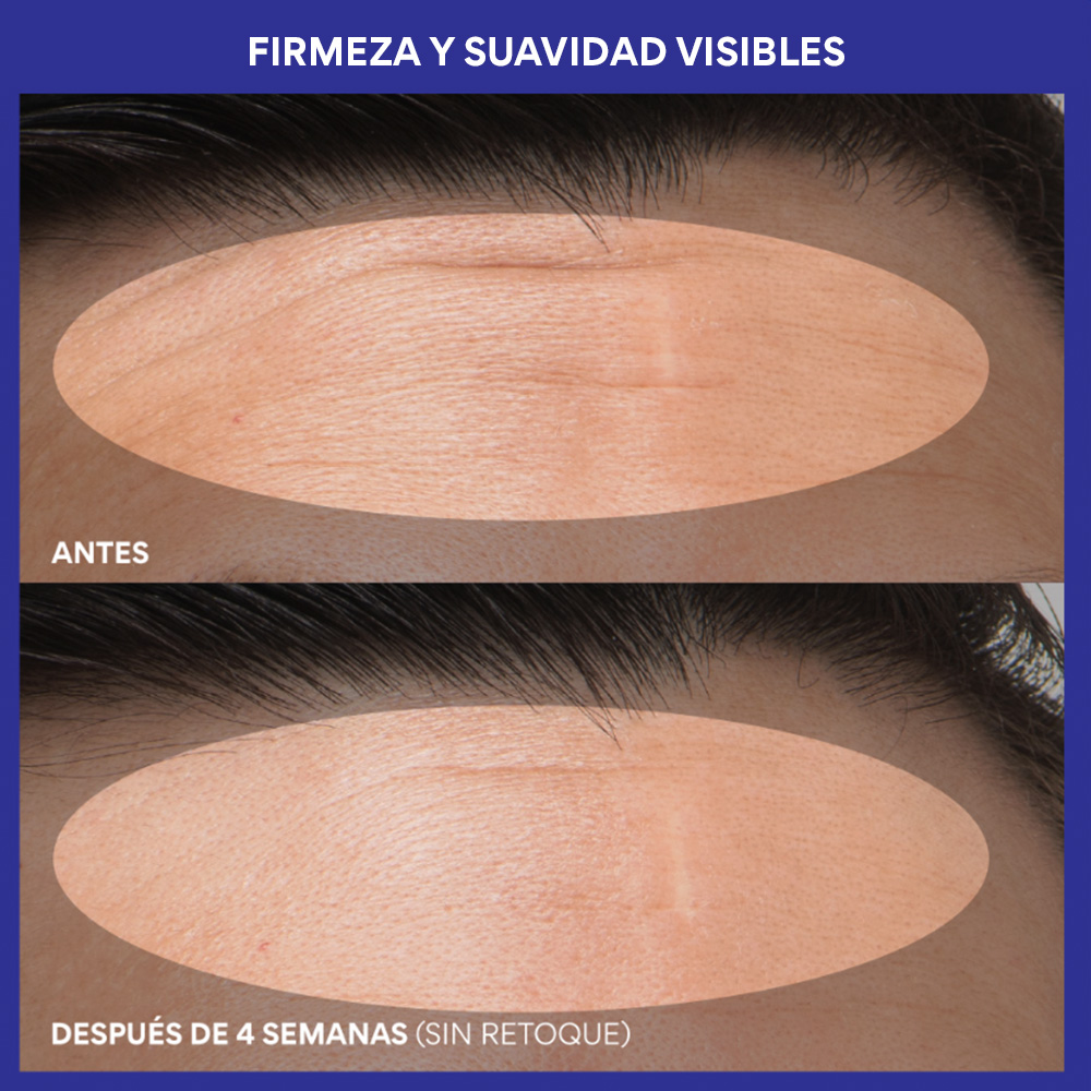 RETINOL GREEN TEA PDRN&trade; FIRMING & SMOOTHING SERUM (S&Eacute;RUM REAFIRMANTE DE T&Eacute; VERDE)